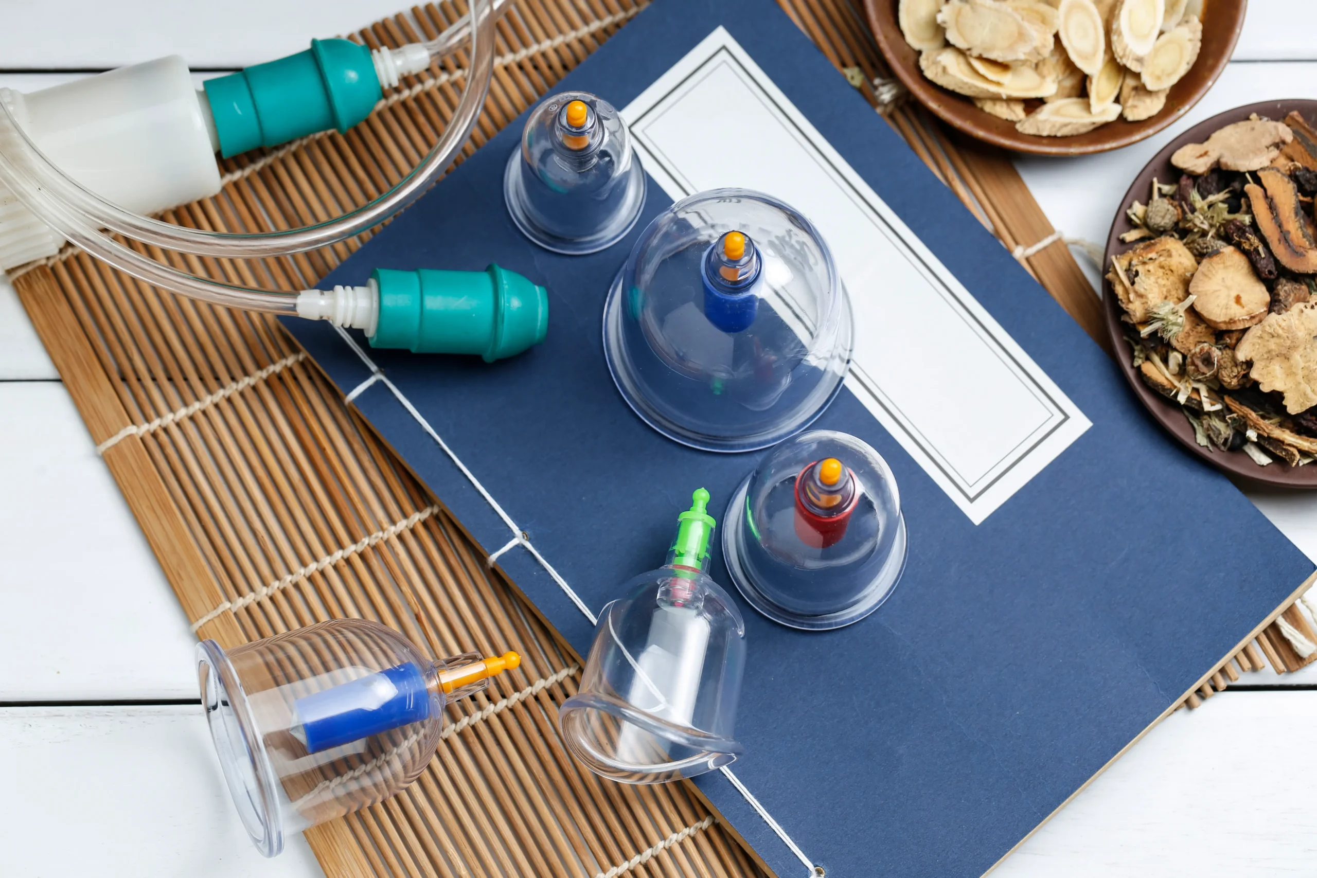 Traditional cupping therapy treatment